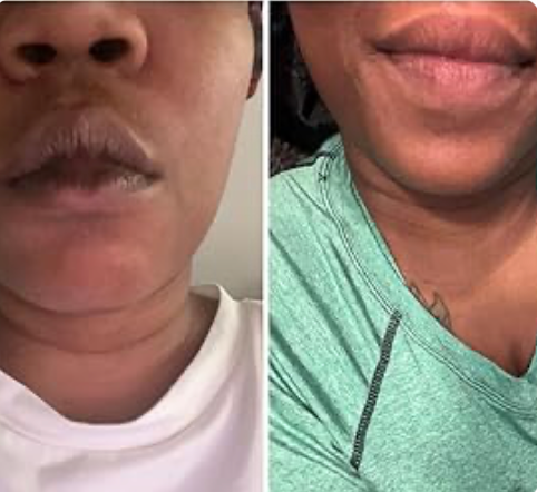 Nuvira™ Dark Lips Exfoliating Scrub