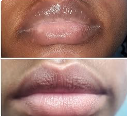 Nuvira™ Dark Lips Exfoliating Scrub