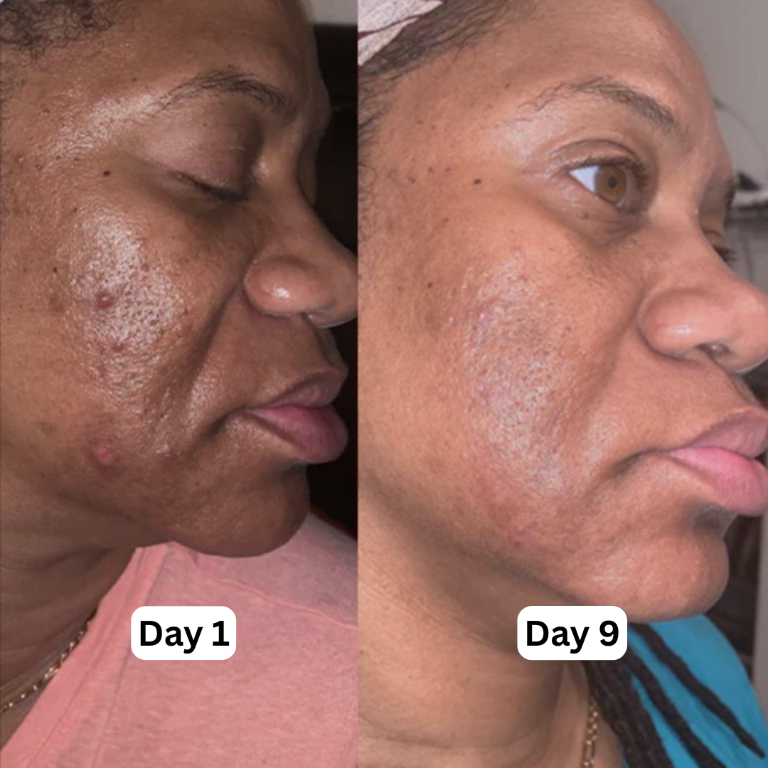 Nuvira™ Hyperpigmentation Brightening Supplement