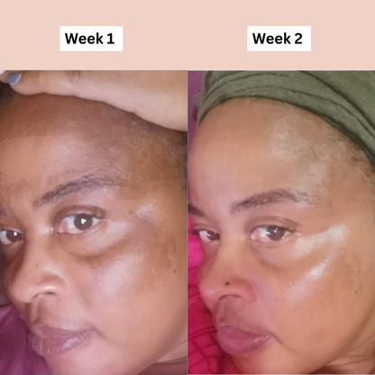 Nuvira™ Hyperpigmentation Brightening Supplement