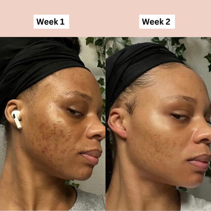 Nuvira™ Hyperpigmentation Brightening Supplement