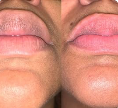 Nuvira™ Brightening Seal Lip Balm(SPF30)